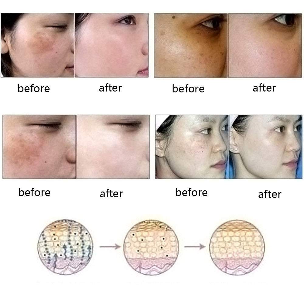 Dredge Meridian Skin Care Natural Pure Removal Acne Stretch Marks Scar Removal Essence oil The Artisan Square