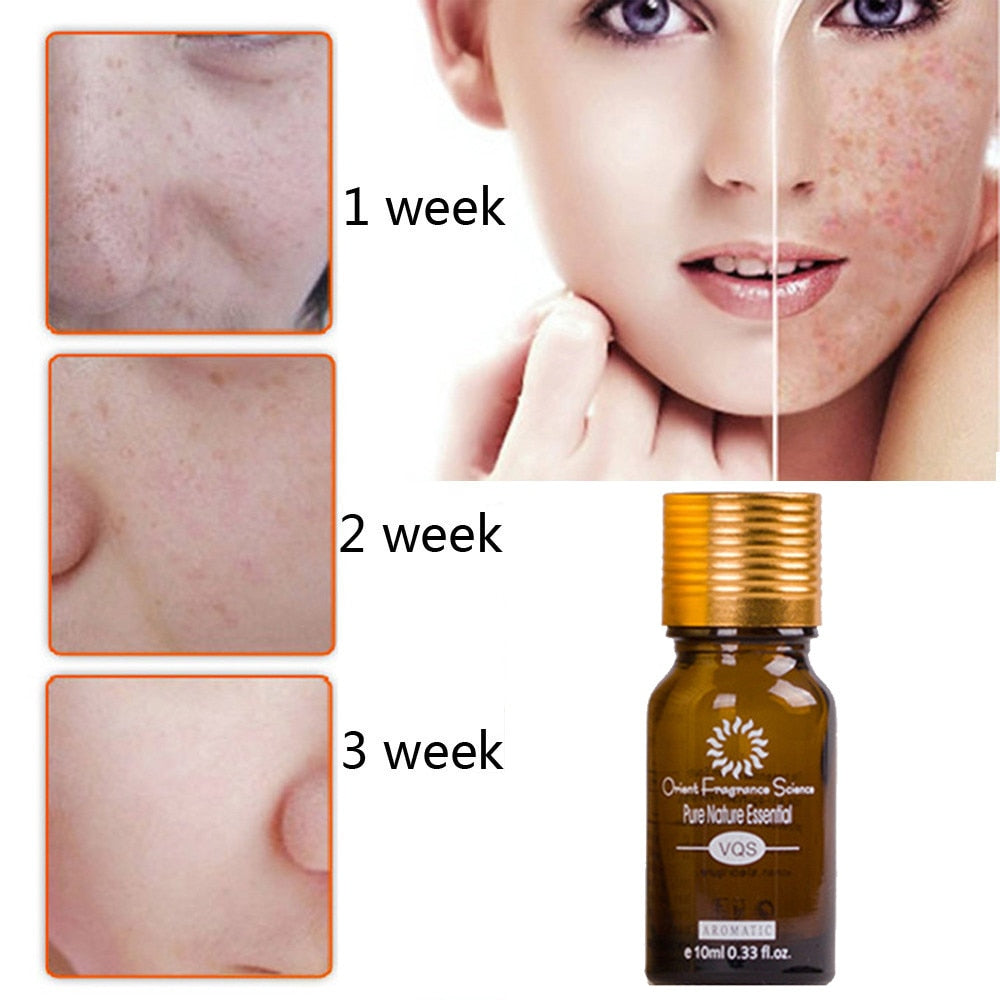 Dredge Meridian Skin Care Natural Pure Removal Acne Stretch Marks Scar Removal Essence oil The Artisan Square